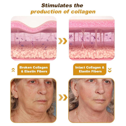 HiveGlow™ - 🐝Bee Venom Wrinkle Repair Cream (Buy 1 Get 1 Free )