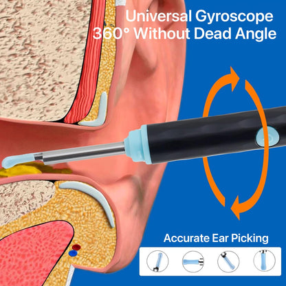 Auronix™ - Smart Ear Wax Cleaner